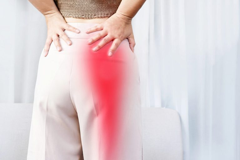 Read more about the article Sciatica