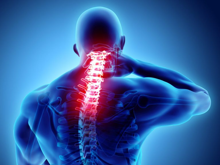 Read more about the article Spinal Arthiritis