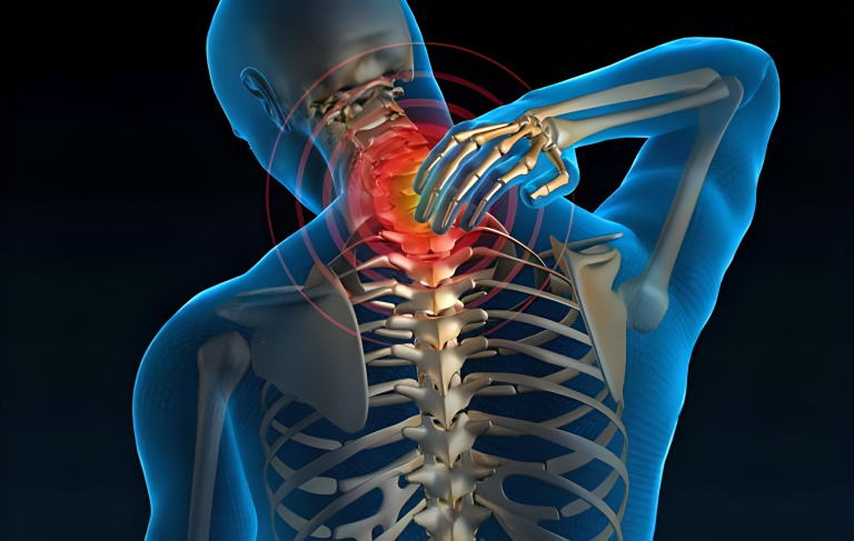 Read more about the article Cervical Spondylitis