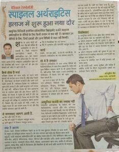 spinal arthritis ilaaj me shuru hua nya duar