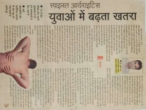 spinal arthritis yuwao me badhta khatra